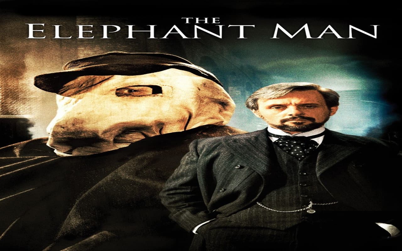 The Elephant Man